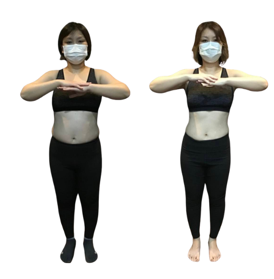 30代女性のBefore／After写真