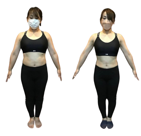 40代女性のBefore／After写真