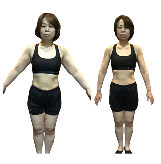 50代女性のBefore／After写真